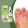 South Moon Nail Repair Lotion Repair Nails Care For Hand And Foot Nails Nourishing And Shining Soft Nail Care